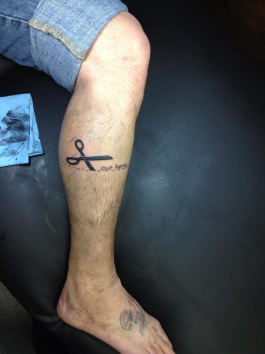 Hombre con un tatuaje de una tijera en donde la van a amputar la pierna
