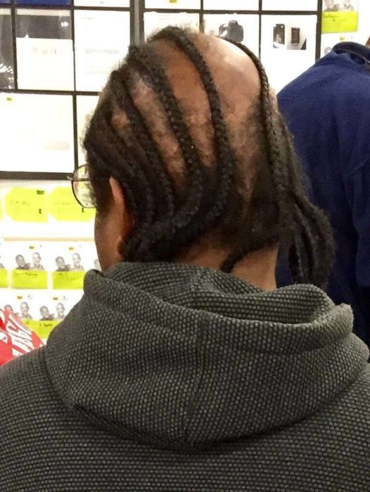 hombre calvo con trenzas en su cabello