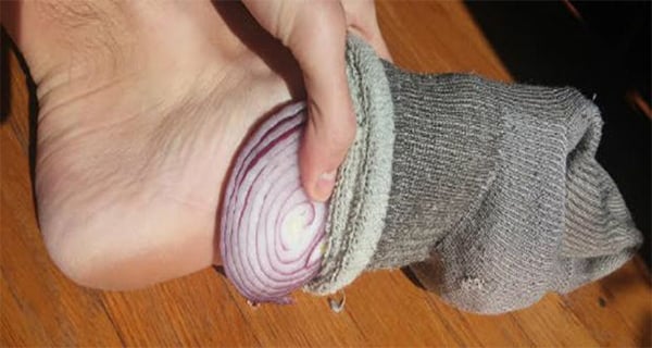 rodaja de cebolla en el pie debajo del calcetin