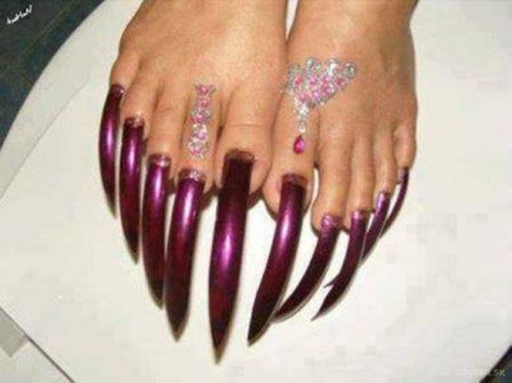 uñas asquerosas de los pies