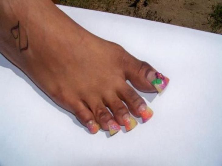 uñas feas en los pies