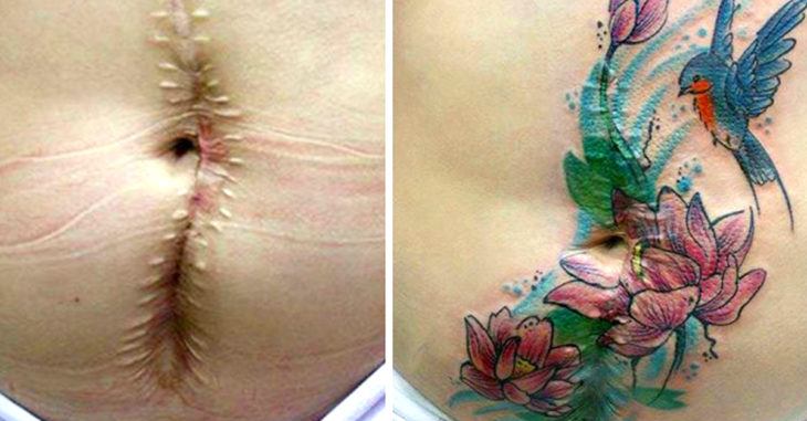 10 Tatuajes que cubren las cicatrices de una vida difícil