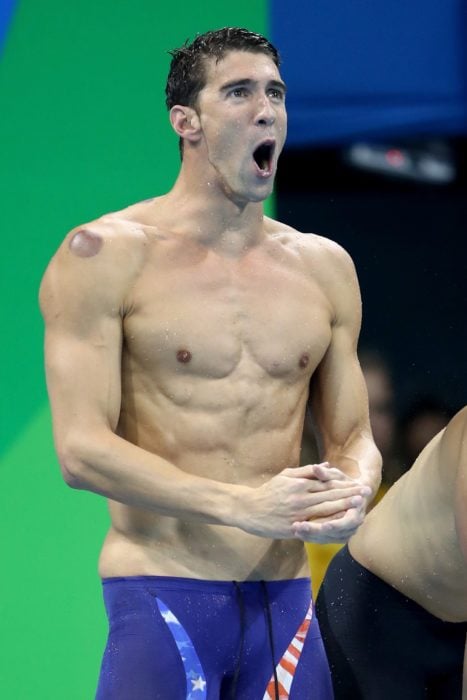 Michael Phelps con un moreton de ventosa en el hombro derecho