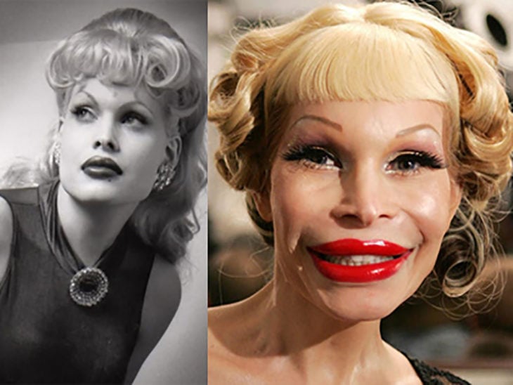 amanda lepore antes y después