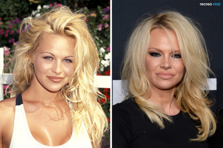 Cirugías. Pamela Anderson antes y después