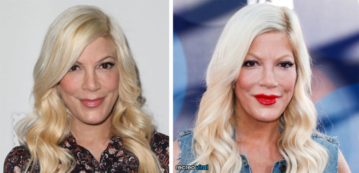 Cirugías. Tori Spelling antes y después