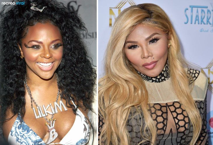 Cirugías. Lil Kim antes y después