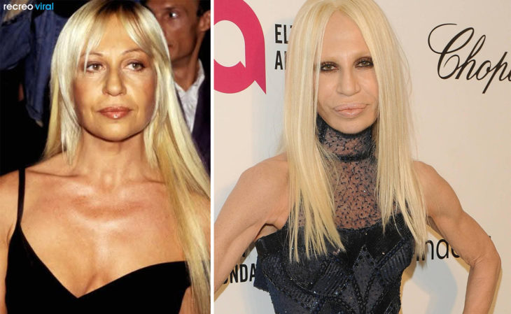 Cirugías. Donatella Versace antes y después