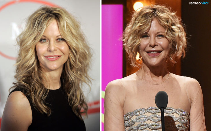 Cirugías. Meg Ryan antes y después