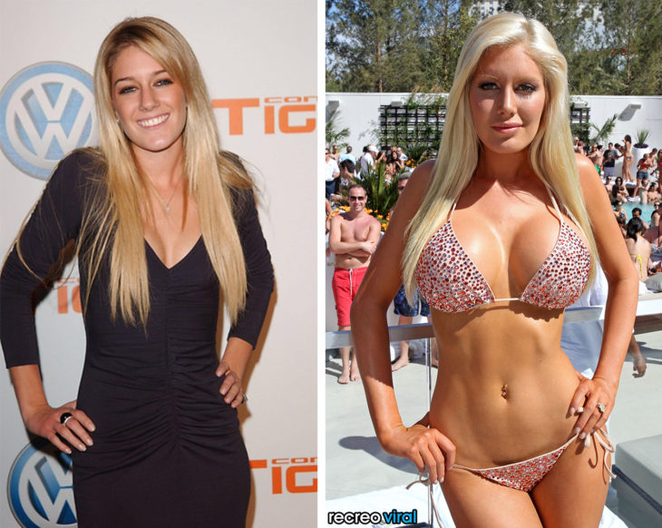 Cirugías. Heidi Montag antes y después