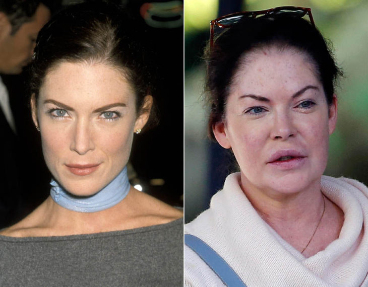 Cirugías. Lara Flynn Boyle antes y después