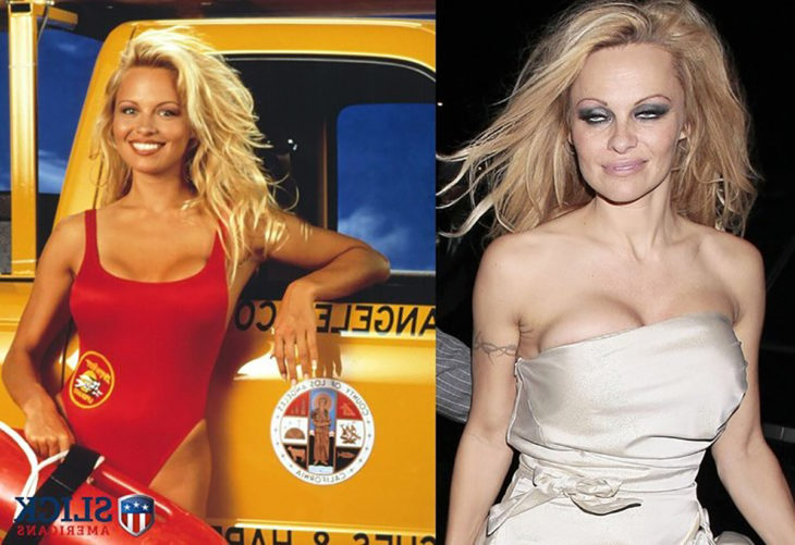 pamela anderson antes y después