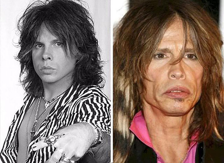 steven tyler antes y después