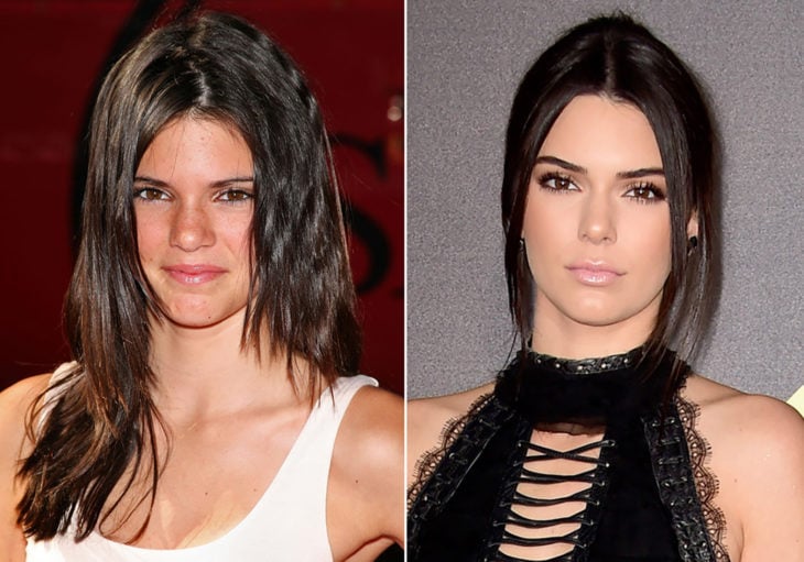 kendall jenner antes y después