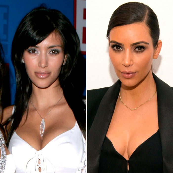 kim kardashian antes y después