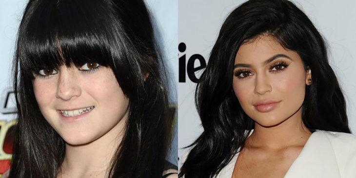 kylie jenner antes y después