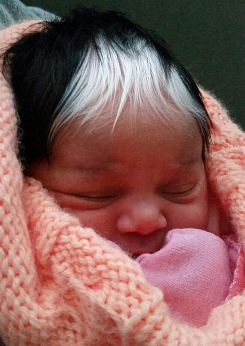 bebé con mechon de cabello blanco 