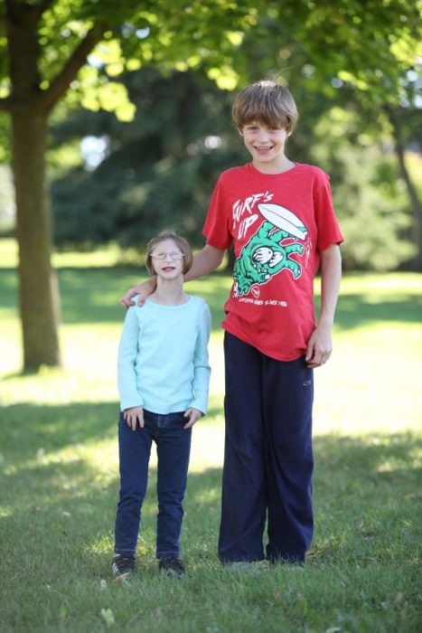 niña con enanismo y su hermano