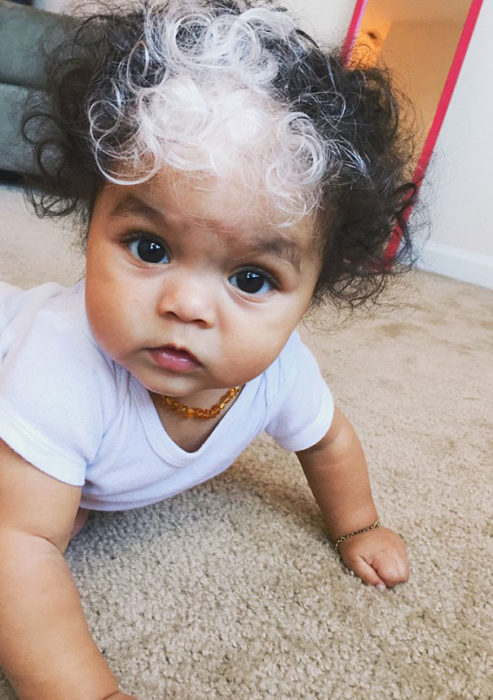 niña de mechón blanco y cabello rizado 