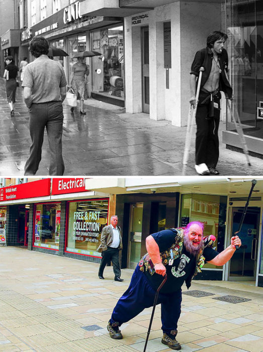 chico metalero con muletas antes y después. 