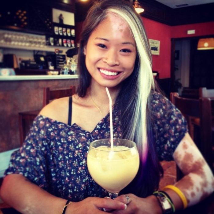 muchacha con vitiligo tomando un trago