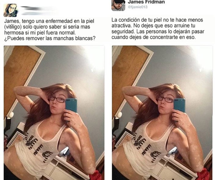 mástertroll se niega a editar a una mujer con vitiligo