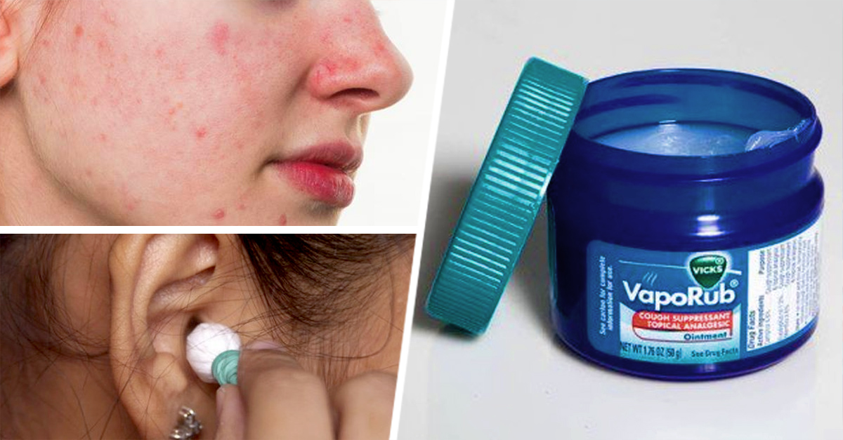 Para que sirve el vick vaporub en el pecho