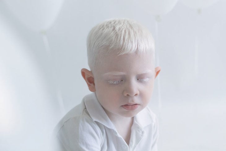 Niño albino con ojos cerrados