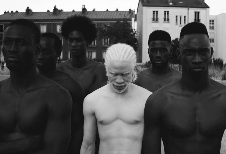 Hombre albino al lado de hombres negros