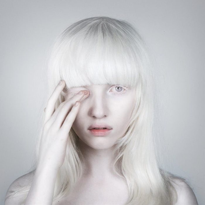 Mujer albina con un ojo cerrado