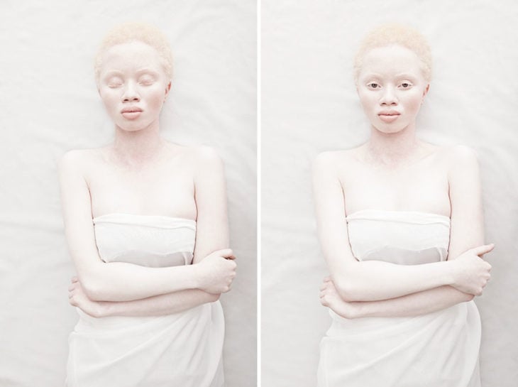 Mujer albina con ojos cerrados y ojos abiertos