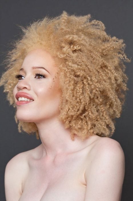 Mujer albina cabello rizado