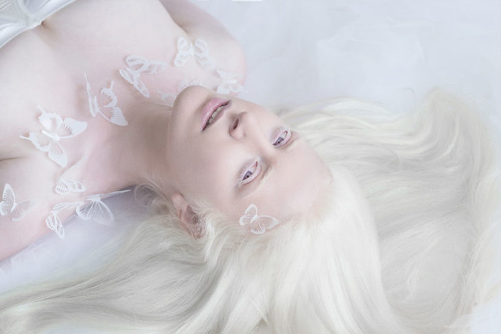 Mujer albina acostada
