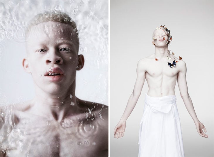 Hombre albino modelo