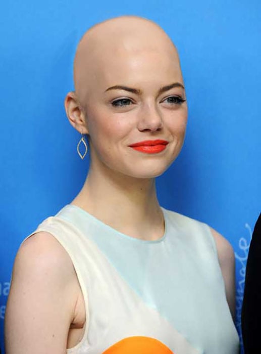 Emma Stone calva