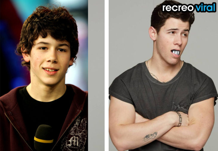 nick jonas antes y después