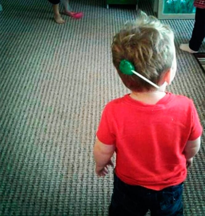 niño con paleta pegada en la cabeza 