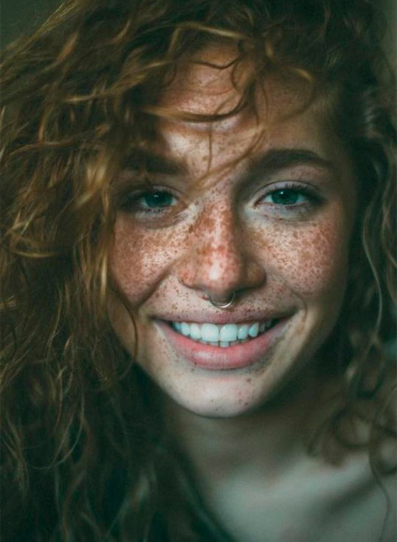 20 personas que demuestran que las pecas son hermosas