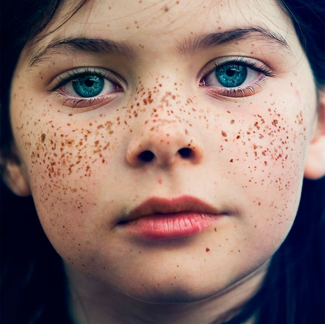 20 personas que demuestran que las pecas son hermosas