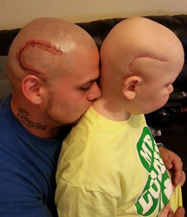 padre se tatúa la cicatriz de cáncer de su hijo