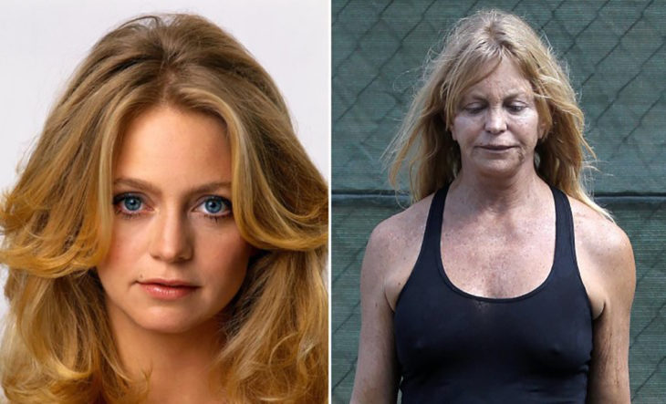 goldie hawn antes y después