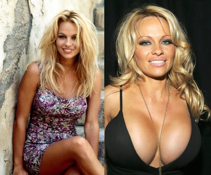 Pamela Anderson antes y después