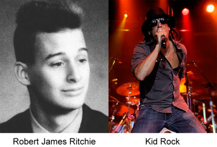 el antes y después de kid rock