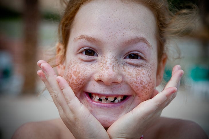 niña feliz y pecosa