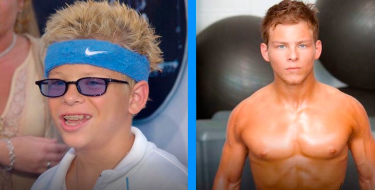 Jonathan Lipnicki antes y después