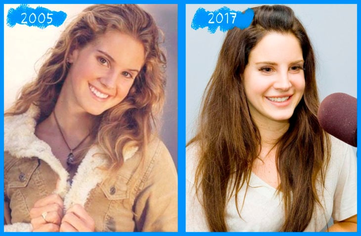 lana del rey antes y después