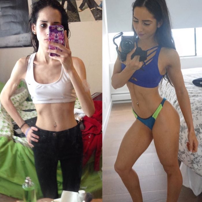 foto antes y después chica en top