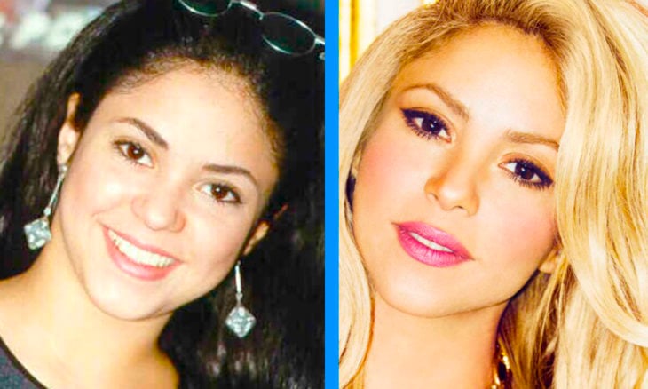 shakira antes y después