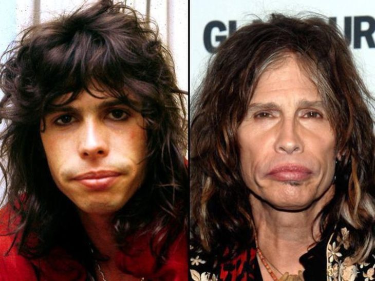 Tommy Lee antes y después