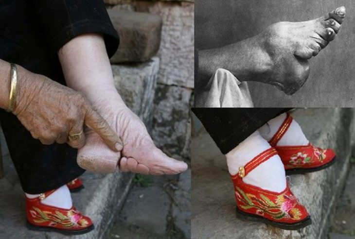 vendajes en los pies de una mujer china